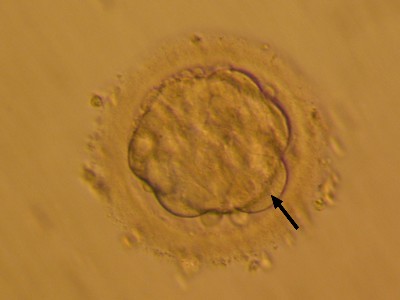Foto 5: Morula po 96 hodinách od umělého oplození. Buňky se již nedají spočítat. Zevní buňky (šipka) jsou zřetelně ohraničeny. Na povrchu preembrya je stále ochranný glykoproteinový obal. Zvětšeno asi 500x.