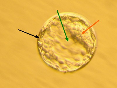 Foto 6: Blastocysta po 100 až 120 hodinách vývoje ve zkumavce. Je to poslední stádium, které můžeme ještě kultivovat mimo organizmus, tedy in vitro. Blastocysta má v podstatě podobu váčku s dutinou (zelená šipka). Její povrchové buňky (černá šipka) jsou základem budoucích obalů plodu. Vnitřní shluk buněk (červená šipka) je základ budoucího embrya a některých přídatných útvarů. Zvětšeno asi 500x.